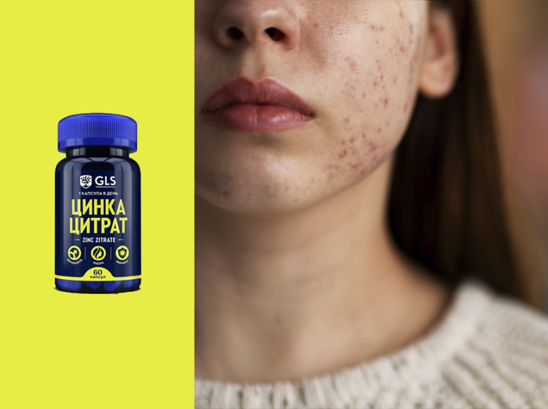 Цинк при акне, усталости и простудах