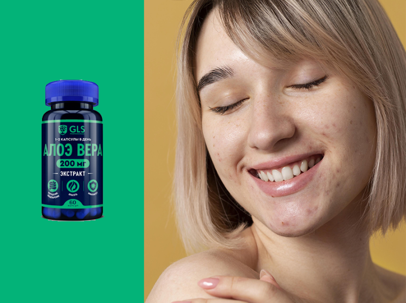 Влияние алоэ вера на прыщи и черные точки Влияние алоэ вера на прыщи и черные точки