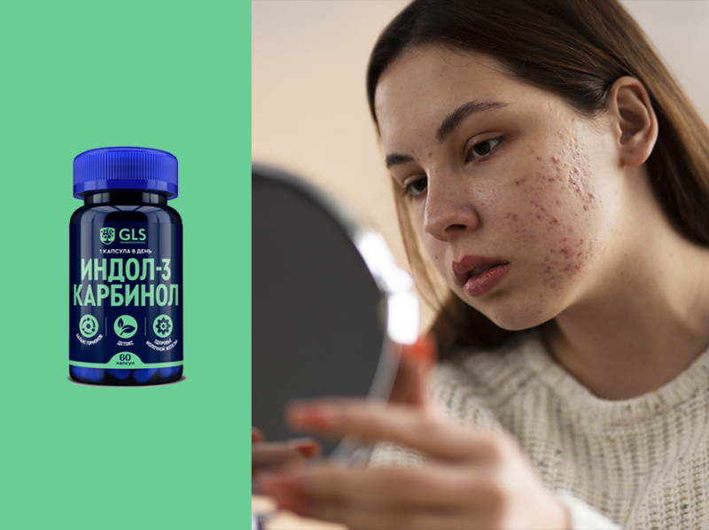 Как предотвратить высыпания на лице Как предотвратить высыпания на лице