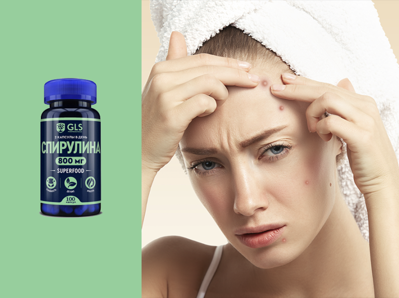 Что пить при акне и проблемах с кожей: нутрицевтики для чистоты изнутри